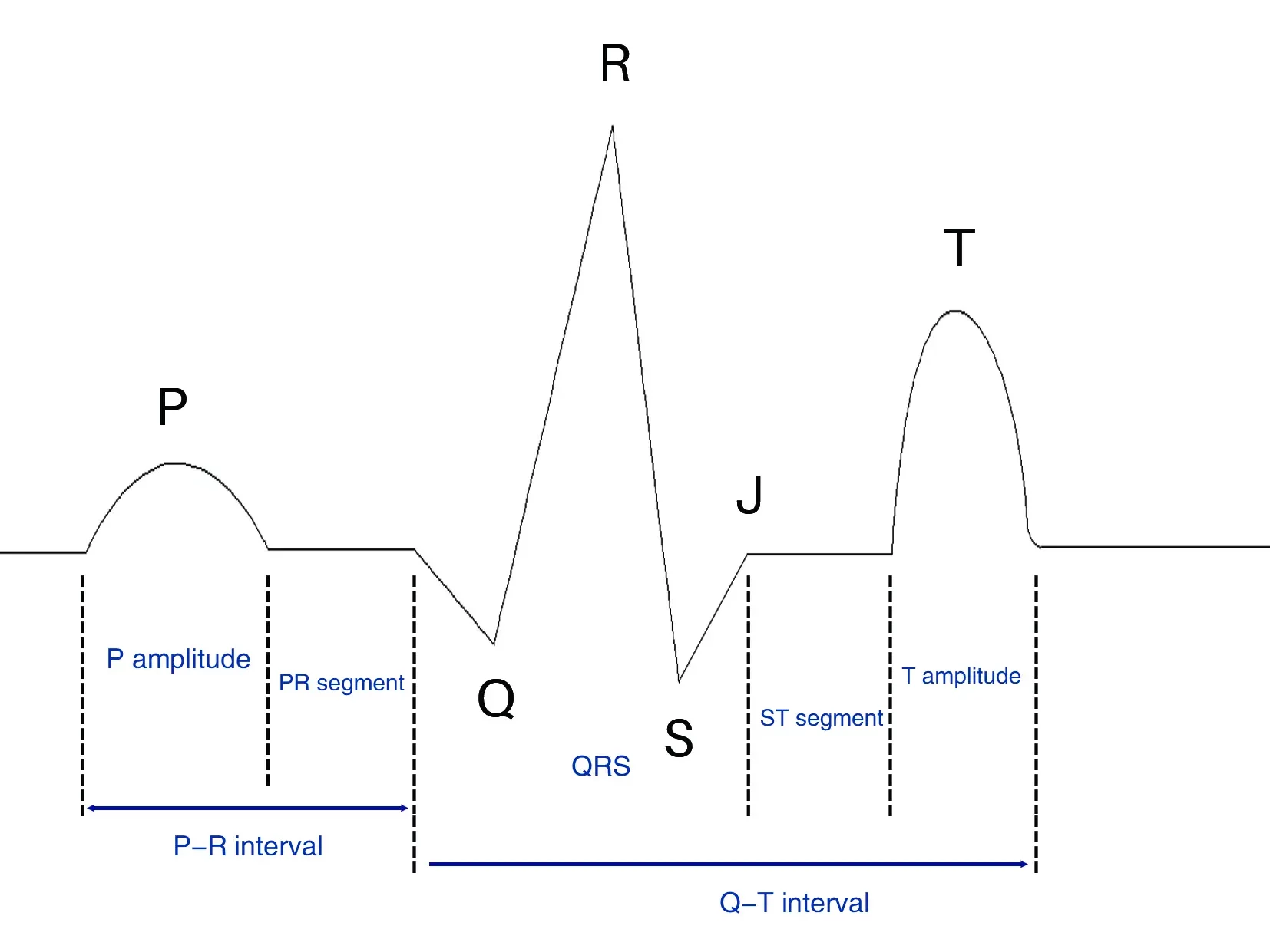 ECG waves